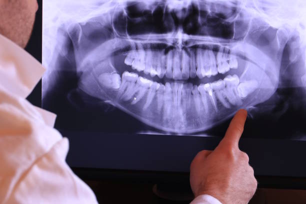 Best Dentist for Dental Trauma  in Napervle, IL