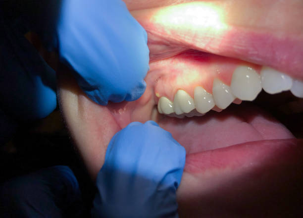 Best Emergency Gum Pain Relief  in Napervle, IL