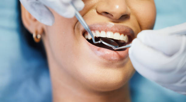 Emergency Dental Filling Replacement in IL