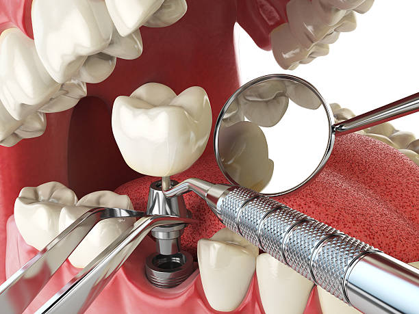 Best Cracked Tooth Emergency Dentist  in Napervle, IL